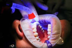 دندانپزشکی-زیبایی